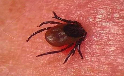 Что делать, если вас укусил клещ?