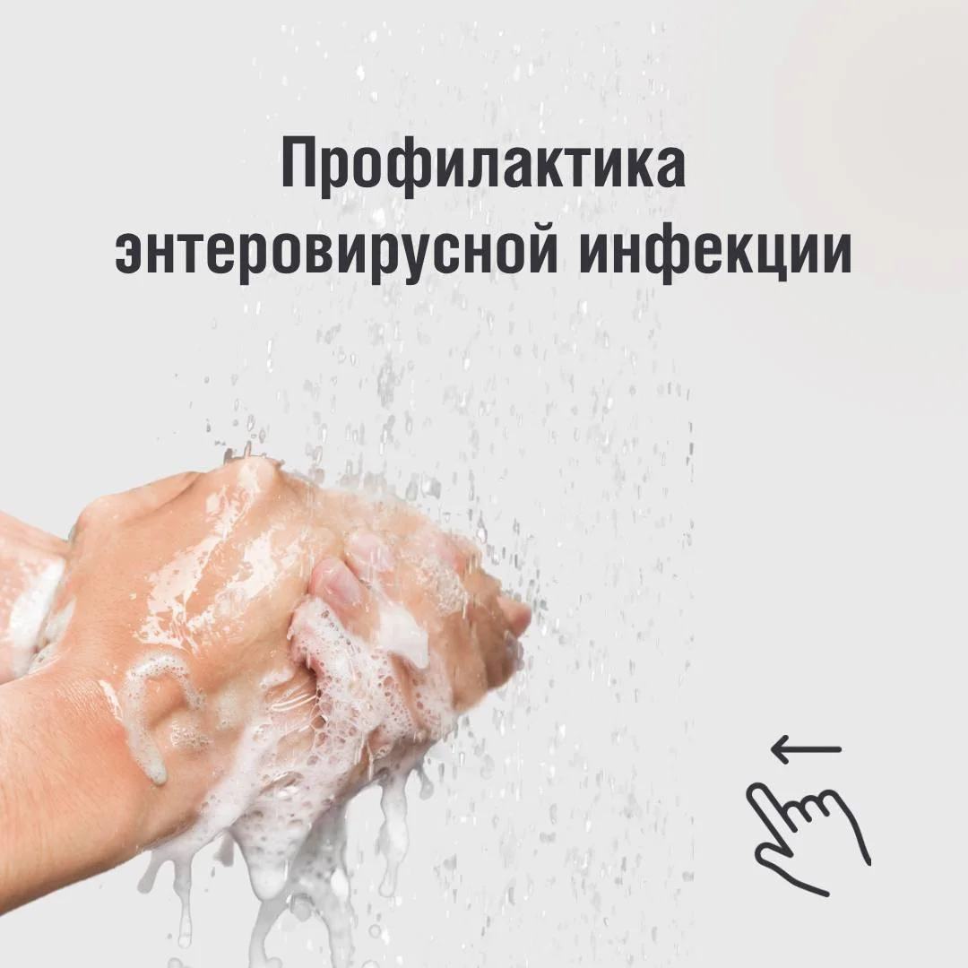 Профилактика энтеровирусной инфекции